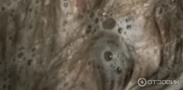 Шампунь Vichy Dercos против перхоти для чувствительной кожи головы фото