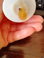 Косметический гель "Биосептин" фото